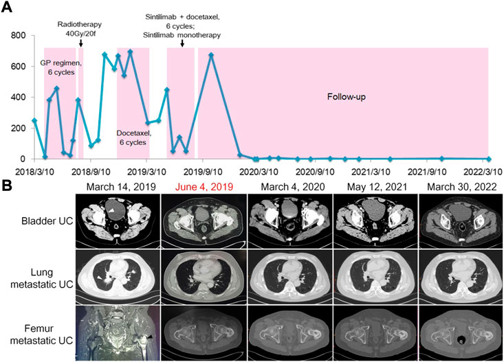Mmr Path Report Pathology & Oncology Research | Case Report: Potential Predictive Value ...