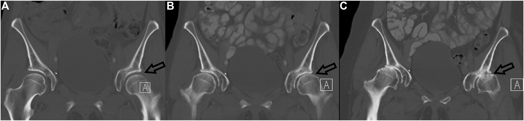 FIGURE 3