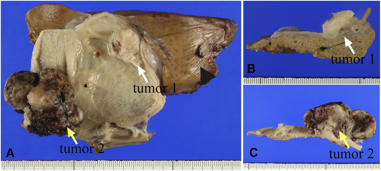 FIGURE 1