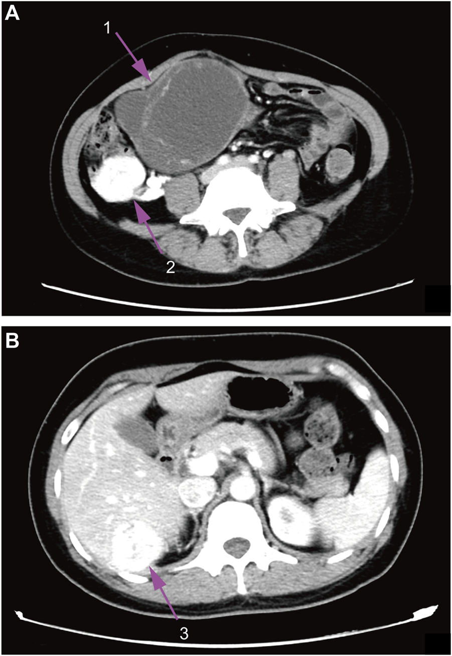FIGURE 1