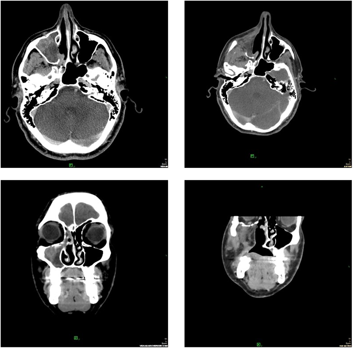 FIGURE 4