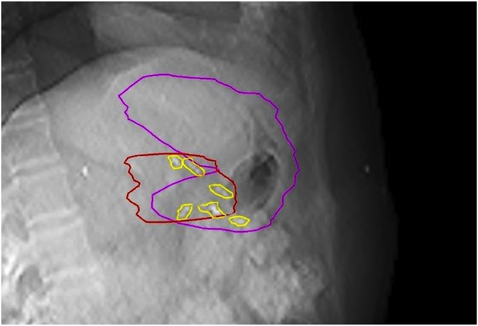 FIGURE 3