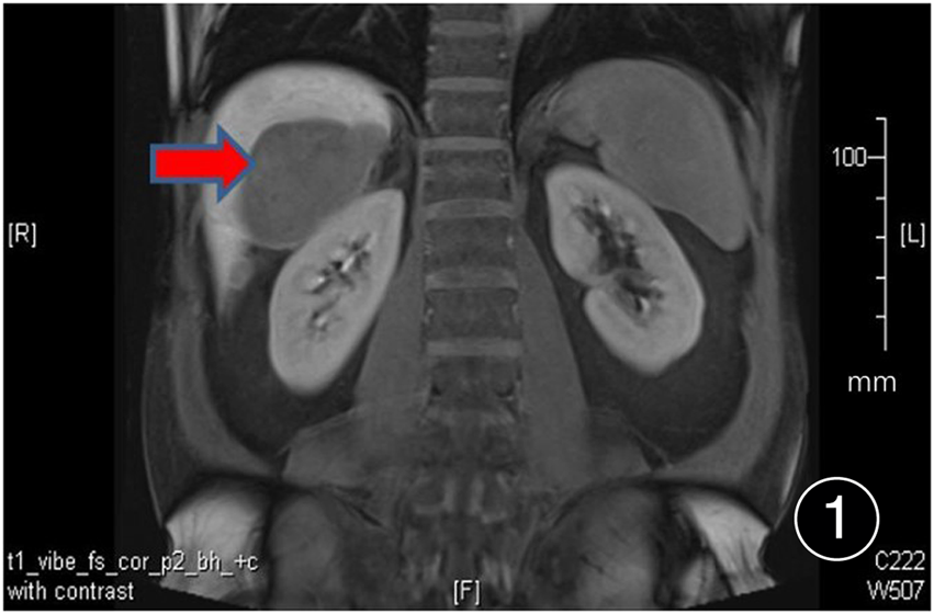 FIGURE 1