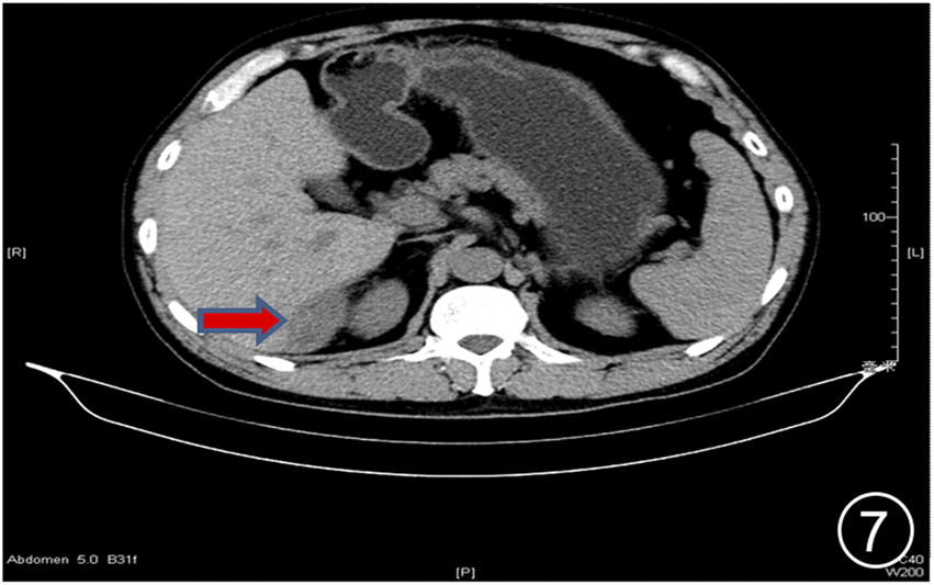 FIGURE 7