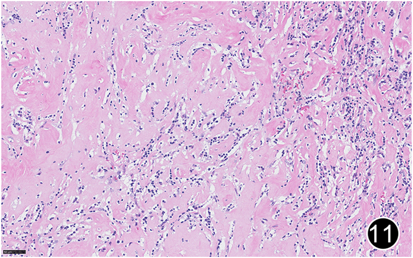 FIGURE 11