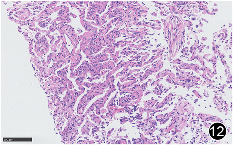 FIGURE 12