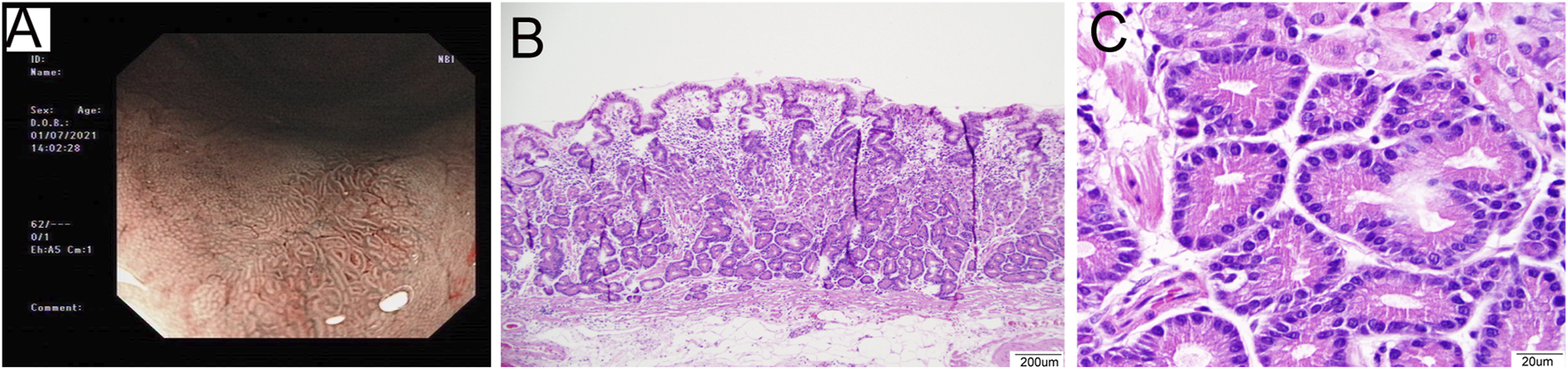 FIGURE 1