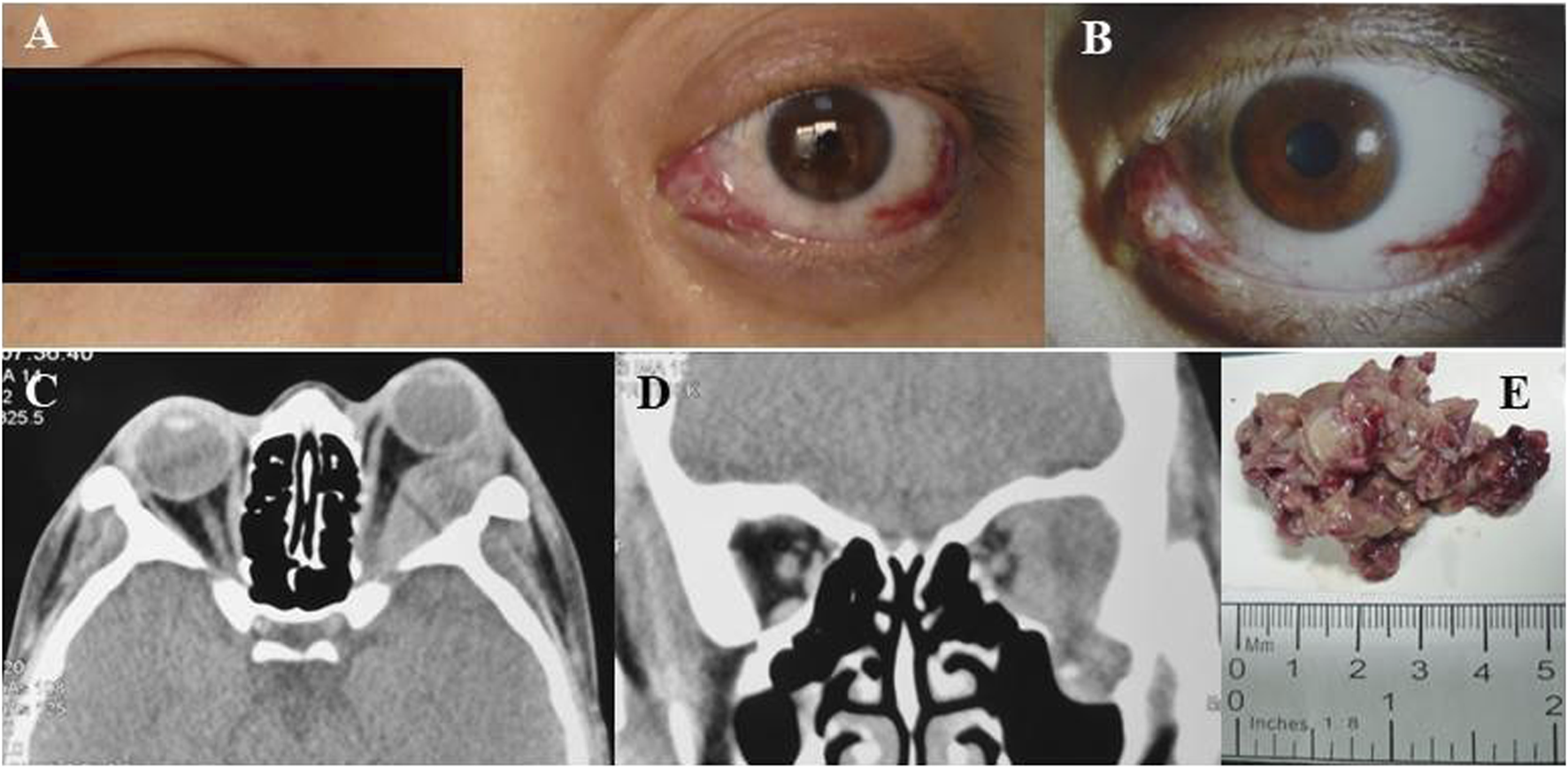 FIGURE 1