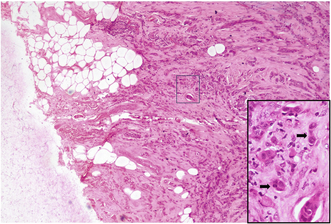 FIGURE 3