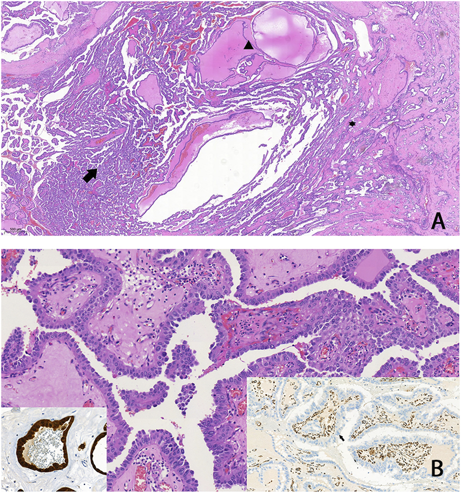 FIGURE 3