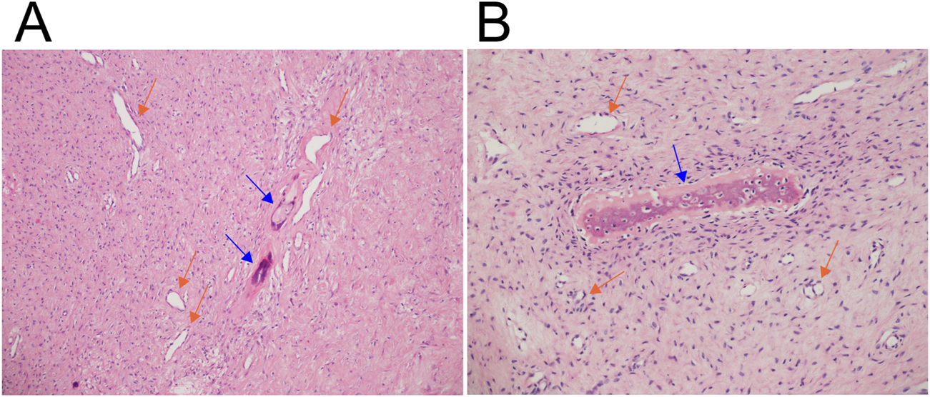 Histological images labeled A and B show tissue samples stained pink and highlighting structural details. Blue arrows indicate particular cells or structures, while orange arrows point to others. The tissue features small, densely packed cells with varying shapes and sizes.