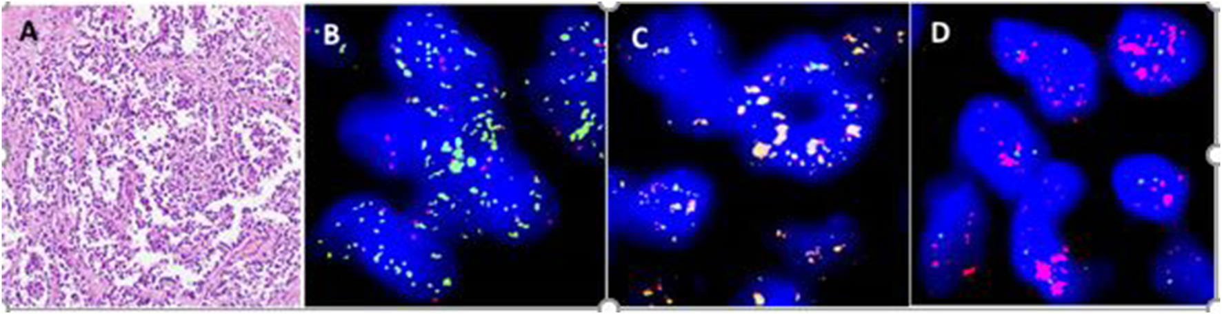 Panel A shows a pink-stained histological tissue section. Panels B, C, and D display blue-fluorescent stained cells, highlighted with various fluorescent markers, indicating different cellular components or molecular targets.