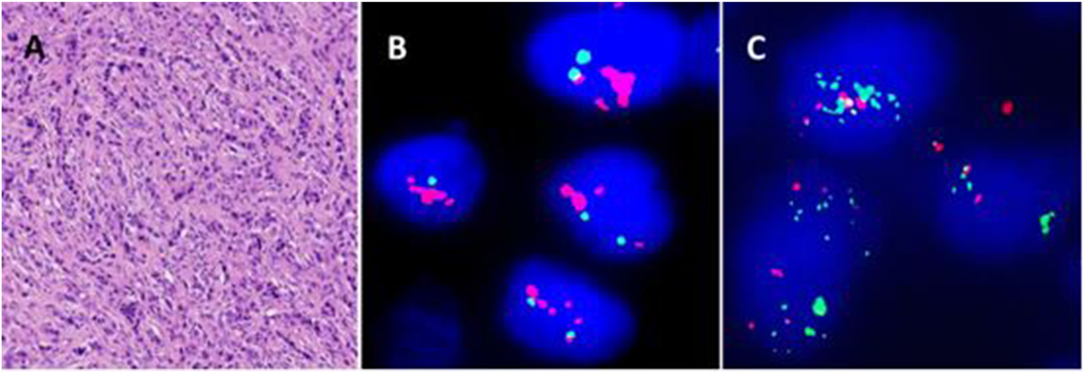 Panel A shows a microscopic image of tissue stained pink and purple, indicating fibrous texture. Panel B displays a fluorescent image with bright blue and pink signals highlighting specific cellular structures. Panel C presents a fluorescent image showing dispersed green, pink, and blue signals against a dark background.