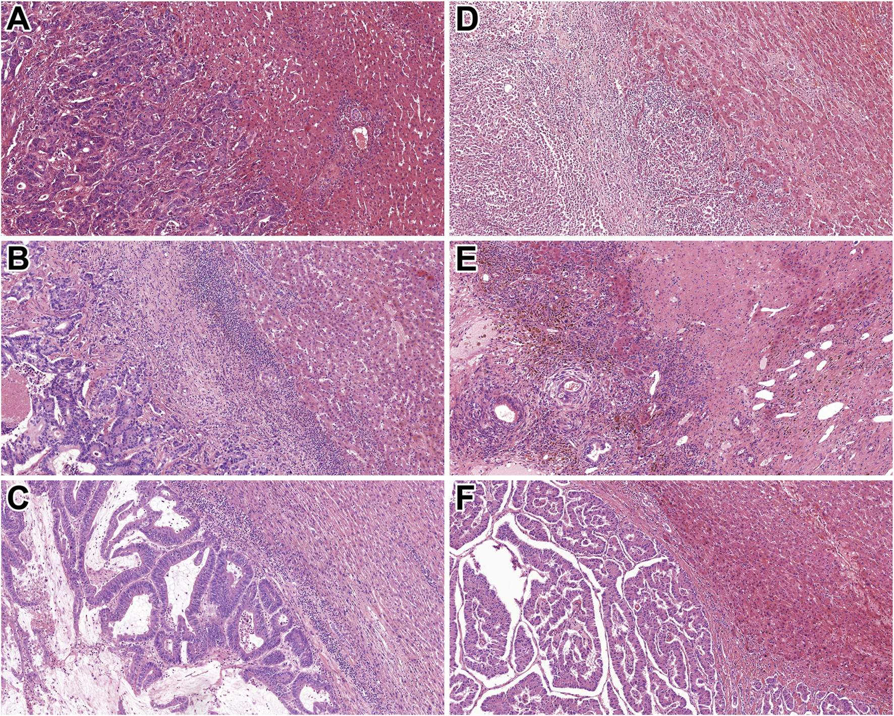Histological images labeled A to F show various tissue samples stained with hematoxylin and eosin. Each image presents different cellular and tissue structures, showcasing variations in density, staining intensity, and morphology. The images highlight pathological changes or characteristics, essential for medical analysis and diagnosis.