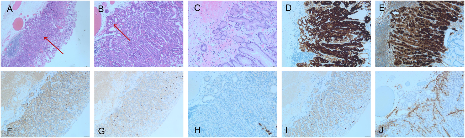 Composite image showing ten histological sections. Panels A and B display tissue with highlighted regions marked by red arrows. Panel C shows a section with light staining. Panels D and E illustrate dark, dense staining patterns. Panels F, G, H, I, and J show varying degrees of light to moderate staining with different structural patterns visible in each section.