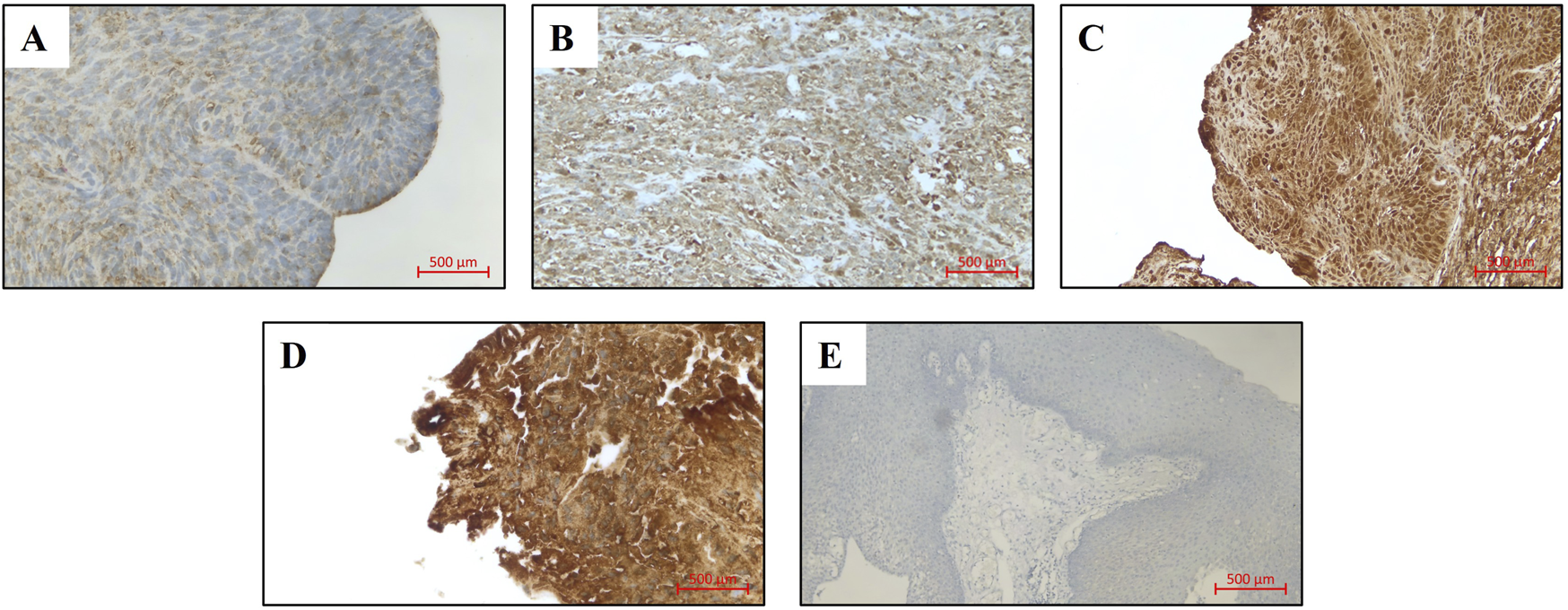 Microscopic images labeled A to E show tissue samples at 500 micrometers scale. Images A to D display varying degrees of brown staining, while image E appears lighter with minimal staining. Each sample texture and pattern is distinct.