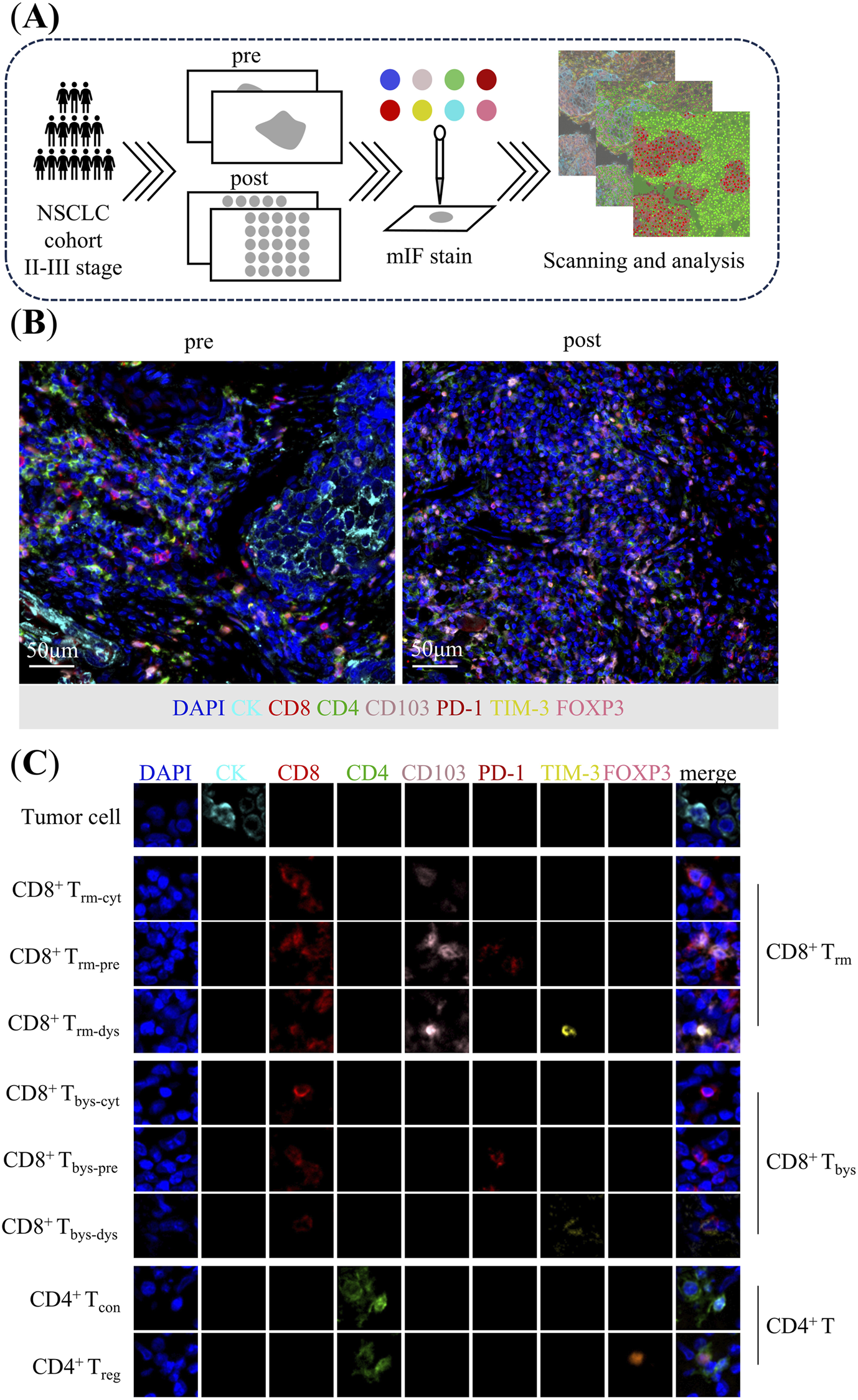 A) Diagram illustrating the process for analyzing NSCLC cohort samples using multiplex immunofluorescence (mIF) staining and scanning. B) Two mIF-stained images of tumor tissue before and after treatment showing various fluorescence markers. C) Grid showing individual fluorescence markers for tumor cells, T cells, and associated conditions, with a merged view on the right.