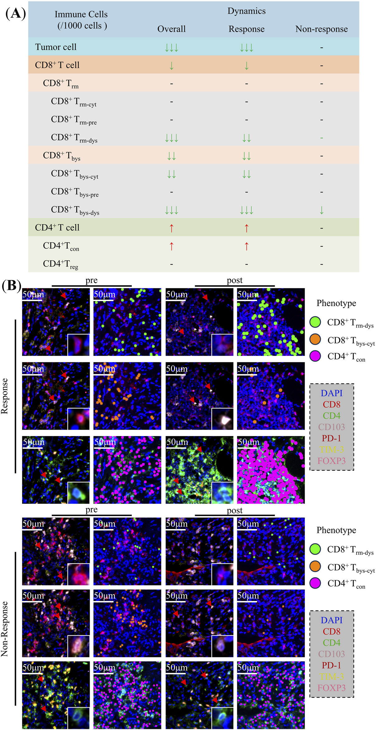 (A) A table displaying dynamics of immune cells in tumor environments, showing CD8+ and CD4+ T cell variations. Arrows indicate increases or decreases for overall, response, and non-response categories. (B) Immunofluorescence images depict CD8+ and CD4+ T cell phenotypes in response and non-response conditions, both pre- and post-treatment. Cells are marked by colors: green for CD8+ T_rm-dys, orange for CD8+ T_bys-cyt, and pink for CD4+ T_con. Insets detail cellular morphology. Scale bars represent fifty micrometers. A legend identifies markers used: DAPI, CD8, CD4, CD103, PD-1, TIM-3, and FOXP3.