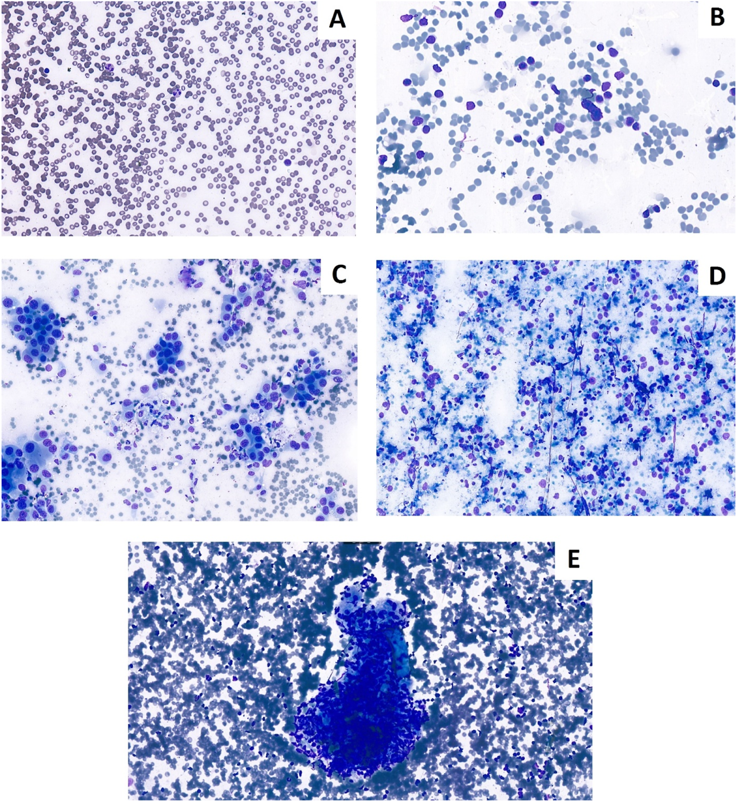 Microscopic images labeled A to E show various cell samples at different magnifications. A displays a dense collection of small, purple-stained cells. B shows cells with larger, prominent nuclei. C and D illustrate cells with distinct blue and purple stains, indicating different cell components. E features a large, densely stained cell cluster surrounded by numerous smaller cells, highlighting a significant cellular structure or mass.