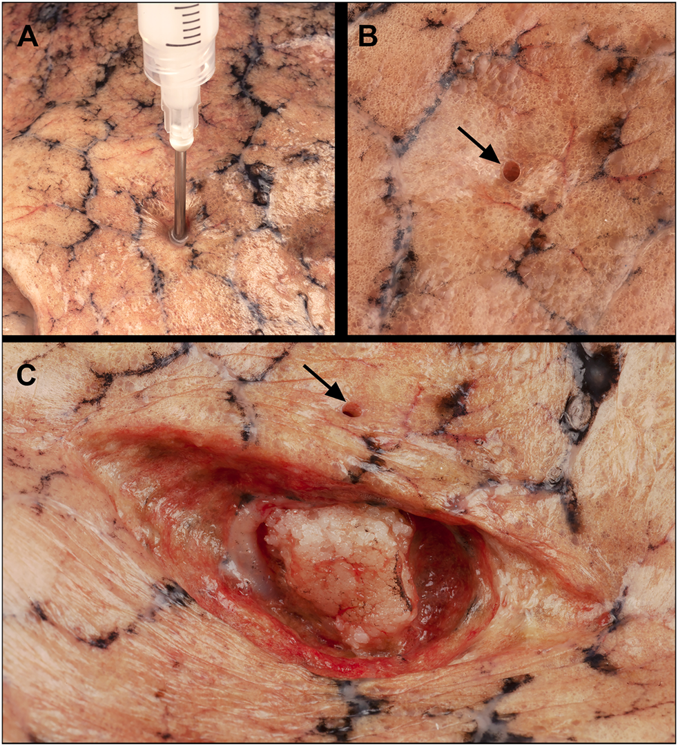 FIGURE 1